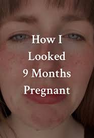 Understanding Postpartum Body Changes After Pregnancy