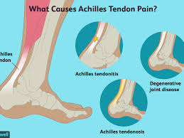 There is typically between 2 to 6 centimeters of the achilles tendon that connects or 'inserts' into your heel bone. Achilles Tendon Pain Causes Treatment And When To See A Doctor