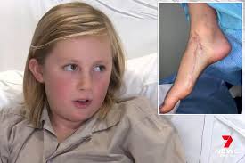 Boy mauled by shark reveals moment he thought 'I'm going to die'