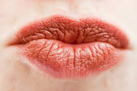 Éstos incluyen medicamentos anti herpes y varias clases de tratamientos para dolor. Herpes Labialis Lippenherpes Das Mussen Mediziner Wissen