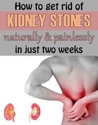 How To Get Rid Of Kidney Stones Naturally And Painlessly In Just Two Weeks Thebeautymania Net Kidney Stones Remedy How To Get Rid Remedies For Kidney Infection