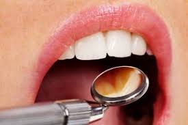 The study of drugs and their effects on living organisms. Oral Cancer Screenings In Houston Tx Dwayne S Dull Dds