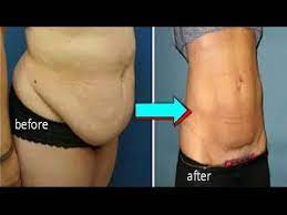 Pin On Ab Exercises