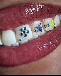 Yondaus Tooth Gem Kit with 402 pcs Crystals and 2 Grillz Teeth