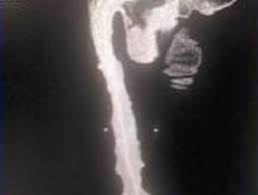 See actions taken by the people who manage and post content. 48 Cm De Long Le Penis Le Plus Long Du Monde Corps Humain Records Du Monde En Images