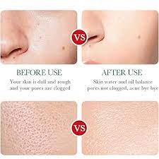 UNIVERSOENLÍNEA.COM 2x1 Liquido Antiacne Serum Reparador Espinillas Acido  Salicilico Elimina Acne Mejora Apariencia Skin Care Alta Calidad Bioqua  Elimina Marcas y Cicatrices : Amazon.com.mx: Belleza