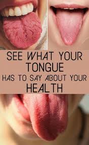 Find Out What Your Tongue Is Telling You The Whoot In 2020 Tongue Health Natural Health Tips Health