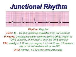 A pt with h/o of htn, dyslipidemia and cad is scheduled for surgery. Junctional Rhythms Bmh Tele