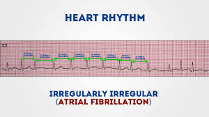 How To Read An Ecg Ecg Interpretation Geeky Medics