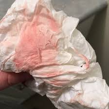 So i had my last depo shot march 1 and decided i didn't want to get back on. What Is This Why Did I Just Wipe Pink Blood With A Little Bit Of Discharge Help I Have An Appt Monday And I Am 8 Weeks Glow Community