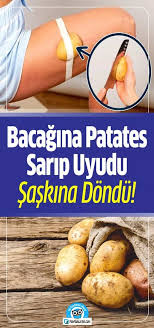 Listemizde 10 Muhtesem Yontem Var Bunlari Iyi Ki Ogrendik Diyeceksiniz Faydali Bilgi Patates Saglikli Yasam Diyet Ipuclari
