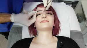 A variation on this piercing, the vertical bridge piercing is a surface piercing, with all of the risks or potential complications related to surface piercings. Why Nose Bridge Piercing Is Cooler Than Traditional Nose Piercing
