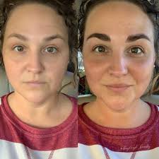 Profile for Beauty by Bayleigh Rose Medical Aesthetician