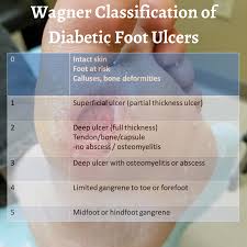 Image result for Wagner Ulcer Classification