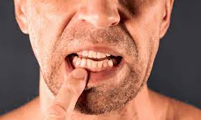 Diabetes And Gum Disease