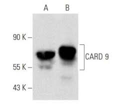 Our directory will help easily find the. Anti Card 9 Antibody A 8 Scbt Santa Cruz Biotechnology