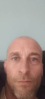 Has anyone done an exam with an eye patch on? I think i'm getting a stye or  conjunctivitis and i don't wanna defer my exams😭