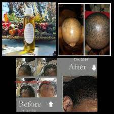 Hair regrowth serum haarspülungsöl zur verbesserung a6g8 von haar j4h5. Hair Oil Formula D Hair Regrowth Serum For Fast Hair Growth Dht Blocker For Men And Women With Jamaican Black Castor Oil