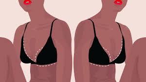 She had to pay a $3,000 deductible and she was a size 40k (small frame, giant breasts). Breast Reduction Surgery Guide What To Expect From Cost To Recovery Time Allure