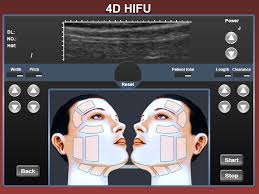 Ti o dara ju 4d hifu oju egboogi-ti ogbo ẹrọ Olupese ati Factory |KES