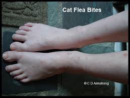 Image result for flea bites