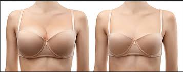 Breast Reduction Surgery in Vadodara, Haripura by MAE Aesthetics ...