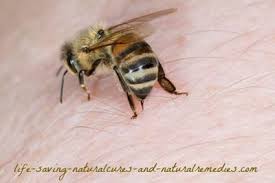 Black And White Wasp Sting Treatment 7 Home Remedies For Bee Stings That Work Like A Charm Here S 7 Of The Best And Fast Acting Remedies For Bee Stings Bee Sting Swelling Bee Sting First Aid