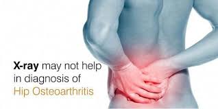 Pin On Ease Joint Pain Naturally