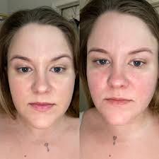 Makeup for rosacea coverage recommendations