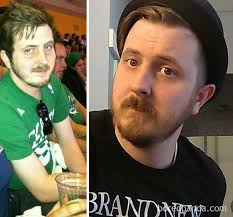 Before & After Pics Show What It's Like To Stop Drinking