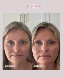 Calling to report… Birthday mode activated. Let me proceed with my  broomstick, bubbles, and birthday magic. 🖤 Cheers to another year 🥂  #halloweenbirthday