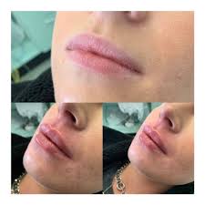 Dr Sillett Aesthetics added a new...