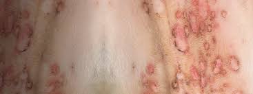 Image result for Pemphigus