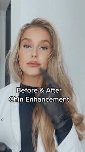 Caroline Larson (@dr.carolinelarson)