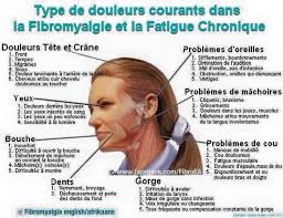 Les cervicalgies regroupent l'ensemble des douleurs de la région cervicale. Epingle Par Paule Sabiani Sur Sante Douleur Tete Fibromyalgie Fatigue Chronique