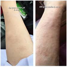 Badan terasa berat dan malas. Kulit Kusam Sebab Pernah Terkena Sihir Santau