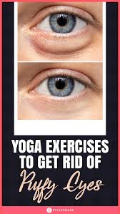 5 Yoga Exercises To Get Rid Of Puffy Eyes Puffy Eyes Eye Exercises Yoga Fitness