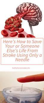 Here S How To Save Your Or Someone Else S Life From Stroke Using Only A Needle Healthy Home Remedies Health Remedies The Cure