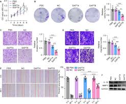 Generation of cytotoxic aptamers specifically targeting fibroblast-like  synoviocytes by CSCT-SELEX for treatment of rheumatoid arthritis | Annals  of the Rheumatic Diseases