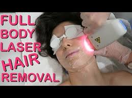 full body laser hair removal does it