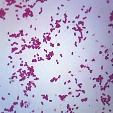 Image result for Shigella