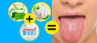 White tongue occurs when the bumps on your tongue swell and trap dead cells, bacteria, and debris between them. 10 Ways To Get Rid Of White Tongue And Make It Healthier
