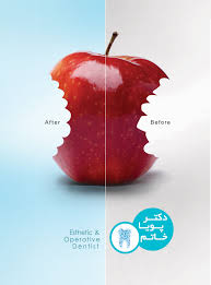 Esthetic Operative Dentist Ceramiccrown Porcelain Copmposite Laminate Estheticdentist Operativedentist Beforeafter B Ortodontiya Zubnoj Stomatologiya