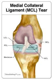 Cpi mcl continues to provide support for the products we have sold for the satellite communications welcome to the cpi satcom division chicago operations website. The Medial Collateral Ligament Mcl Knee Ligament Injury Ligament Tear Knee Ligaments