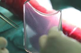 Boy Is Given New Skin Thanks To Gene Therapy Newsportal Ruhr Universitat Bochum