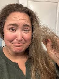 Hair products for lupus patients?