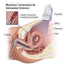 Common Tests During Pregnancy
