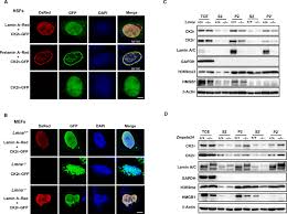 Lamin A Buffers Ck2 Kinase Activity To Modulate Aging In A