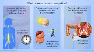 Pin On You And Constipation