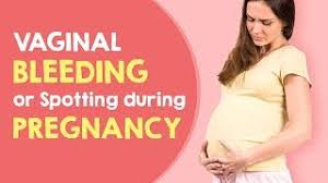 It can be alarming to find that you're spotting at 8 weeks pregnant because, yes, blood can be a sign of miscarriage. Vaginal Bleeding Or Spotting During Pregnancy Youtube